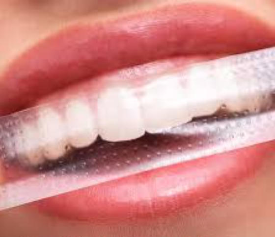 Teeth Whitening Strips.jpg